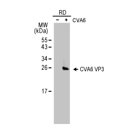 Coxsackievirus A6 VP3 antibody (GTX132689)