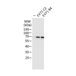 Enterovirus 71 antibody