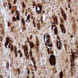 EV71 VP1 antibody