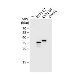 Enterovirus 71 VP1 antibody