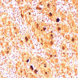 Enterovirus 71 2B antibody