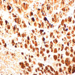 Enterovirus 71 3AB antibody