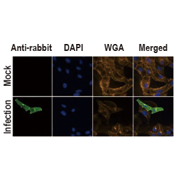 Influenza A virus M2 (matrix protein) antibody