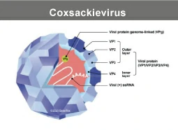 Coxsackievirus Coxsackievirus