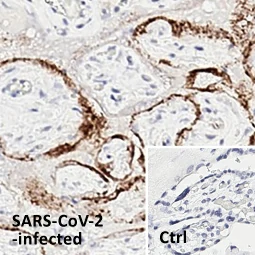 SARS-CoV-2 (COVID-19) Spike S1 antibody [HL6] (GTX635654)
