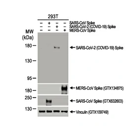 SARS-CoV-2 (COVID-19) Spike S1 antibody [HL6] (GTX635654)