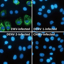 Zika Virus Envelope protein antibody (GTX133314) Zika Virus Envelope protein antibody (GTX133314)