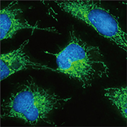 Hexokinase II antibody Hexokinase II antibody