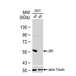 GPI antibody GPI antibody