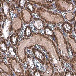 TOMM20 antibody (GTX133756)