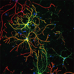 Glutamine synthetase antibody [GT1055]