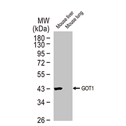 GOT1 antibody [GT638]