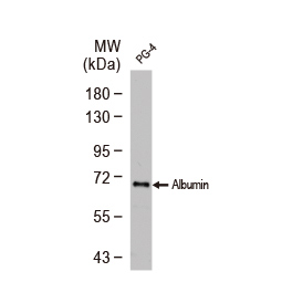 Albumin antibody Albumin antibody