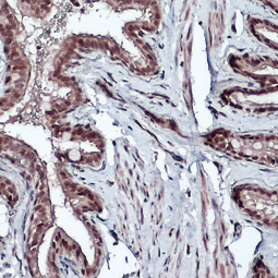 Bmi1 antibody Bmi1 antibody