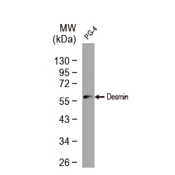 Desmin antibody Desmin antibody