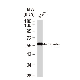Vimentin antibody Vimentin antibody