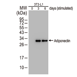 Adiponectin antibody Adiponectin antibody