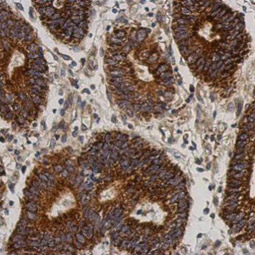 C21orf2 antibody [N1C2]