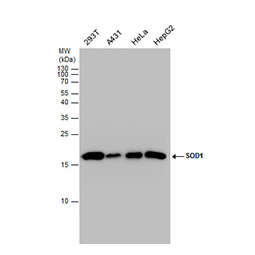 SOD1 antibody
