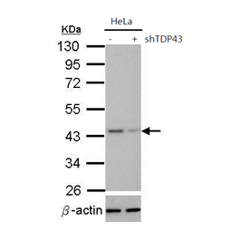 TDP43 antibody