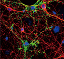 Aquaporin 4 antibody (GTX133151)