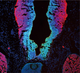 SOX2 antibody 
(GTX101507)