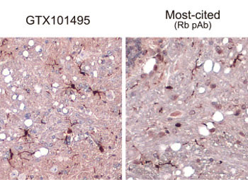 Iba1 antibody Iba1 antibody