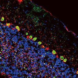 Calcitonin antibody(GTX134005) Calcitonin antibody(GTX134005)
