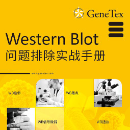 Western Blot问题排除实战手册 Western Blot问题排除实战手册