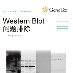 Western Blot实验疑难解答 Western Blot实验疑难解答