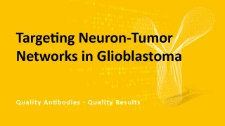 Targeting Neuron-Tumor Networks in Glioblastoma Targeting Neuron-Tumor Networks in Glioblastoma