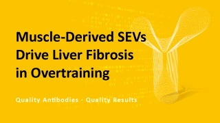 Muscle-Derived SEVs Drive Liver Fibrosis in Overtraining Muscle-Derived SEVs Drive Liver Fibrosis in Overtraining