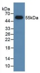 Rat DKK1 protein, His and GST tag. GTX00063-pro