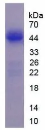 Human LMTK3 protein, His and SUMO tag (active). GTX00071-pro