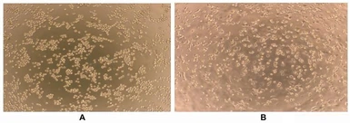 Human Interferon gamma protein, His tag (active). GTX00084-pro