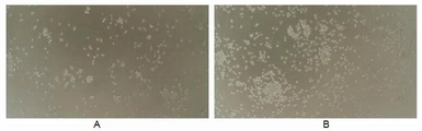 Human IL2 protein, His tag (active). GTX00092-pro