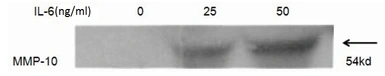 Human IL6 protein, His and GST tag (active). GTX00094-pro