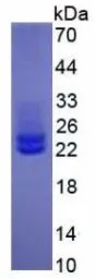 Human IL6 protein, His tag (active). GTX00095-pro