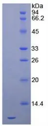 Human SDF1 protein, His tag (active). GTX00098-pro