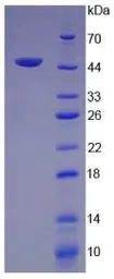 Human VEGFC protein, His tag (active). GTX00104-pro