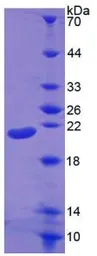 Human IL1 beta protein, His tag (active). GTX00116-pro