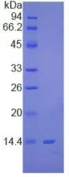 Human S100 beta protein, His tag. GTX00117-pro