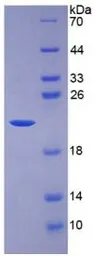 Human IL7 protein, His tag (active). GTX00118-pro
