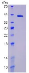 Human HIF1 alpha protein, His tag. GTX00119-pro