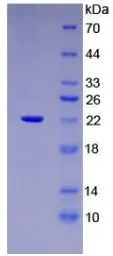 Human ARMET protein, His tag (active). GTX00139-pro