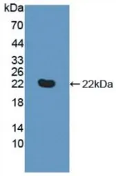 Human TNFRSF14 protein, His tag. GTX00145-pro