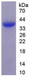 Human MAGP1 protein, His tag. GTX00174-pro