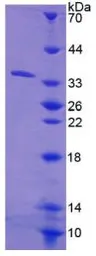 Human CES1 protein, His tag. GTX00177-pro