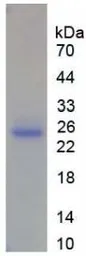 Human MMP13 protein, His tag (active). GTX00191-pro