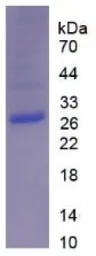 Human Galectin 3 protein, His tag (active). GTX00195-pro